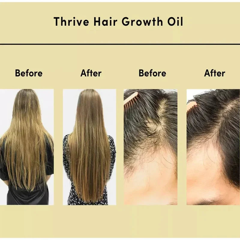 Thrive Grown Hair Oil anti Hair Loss Scalp Treatment Serum Gisou Rosemary Oil for Hairs Collagen Cabello Hair Care